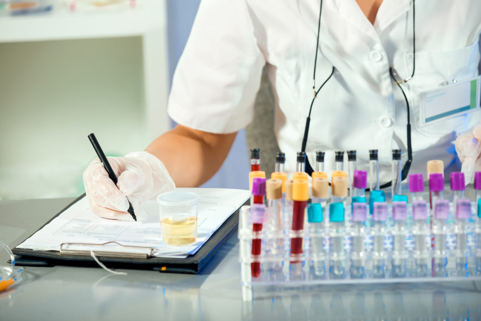 EtG Testing Know the Facts SCRAM Systems of Illinois